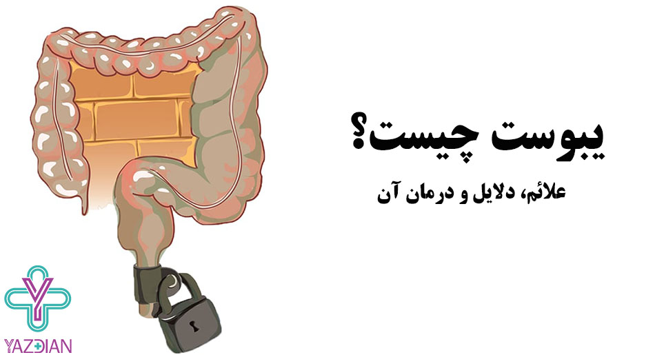 یبوست چیست؛ علائم، دلایل و درمان آن